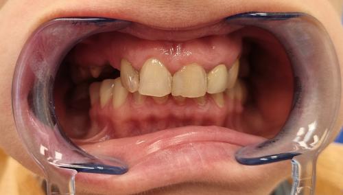 1 - Przed Odbudową