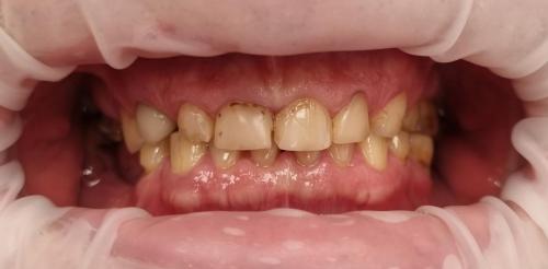 2 - Przed Odbudową