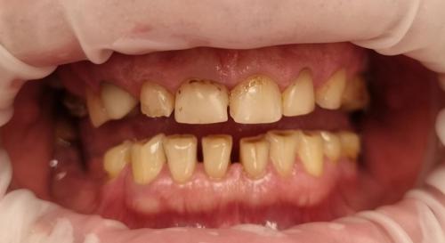 2 - Przed Odbudową